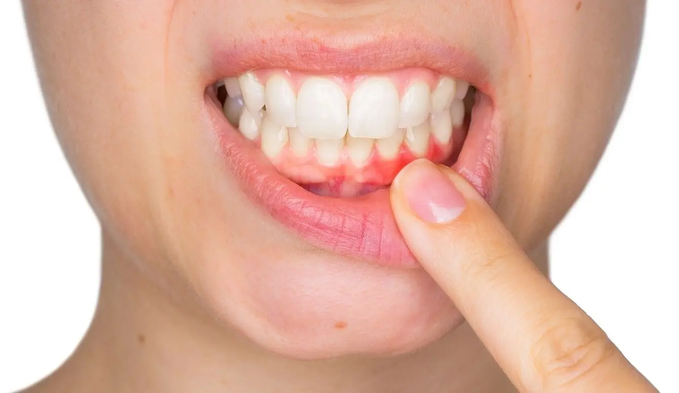 Как выносить ребенка и сохранить безупречную улыбку